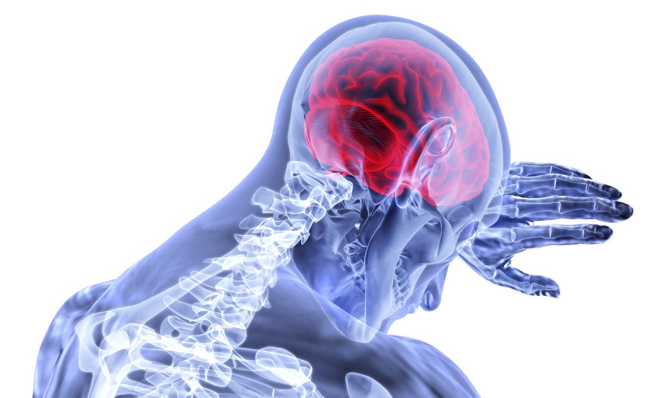 درمان تکان خوردن مغز یا کانکاشن مغزی