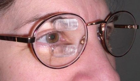 منشور برای درمان دو بینی چشمی