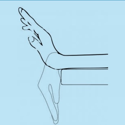 تمرین خم کردن مچ دست به بالا و پایین